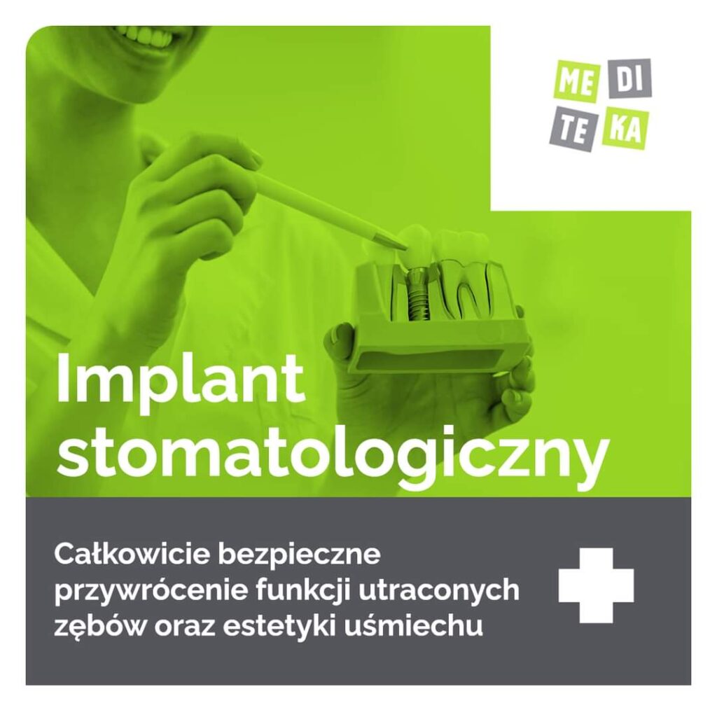 implant stomatolog opole